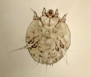acaro della scabbia