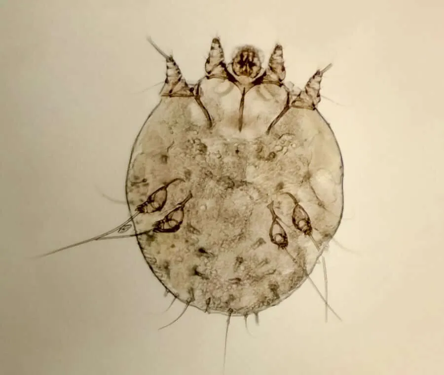 acaro della scabbia