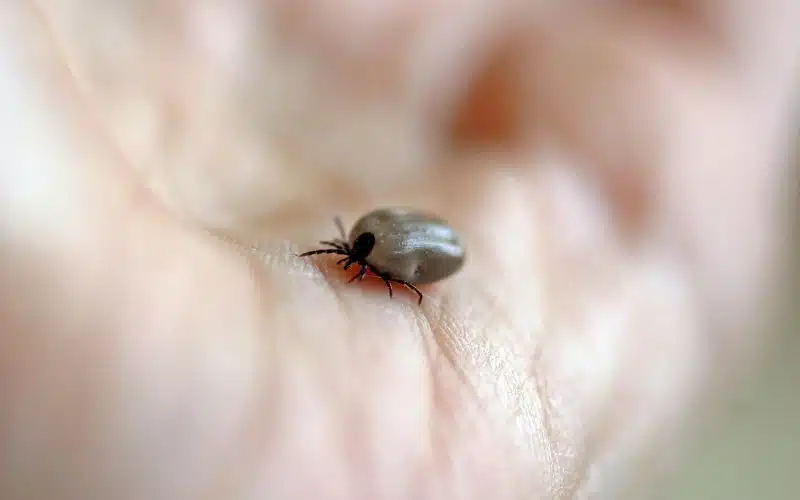 Come eliminare gli acari della pelle definitivamente